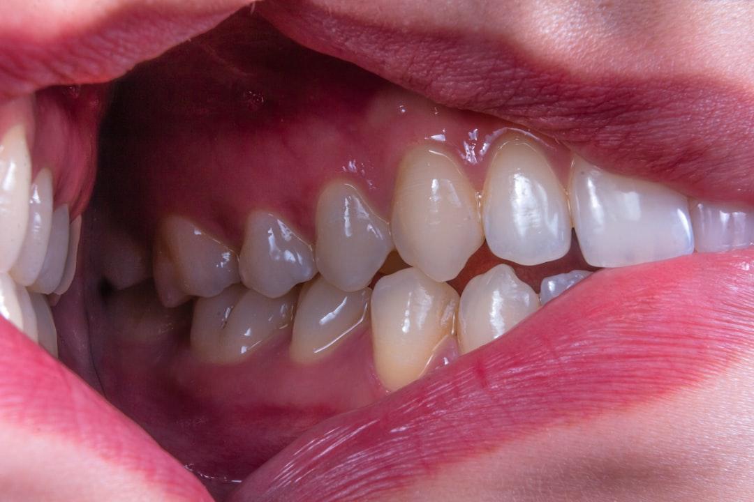 Oral Surgery Billing Authorization Form