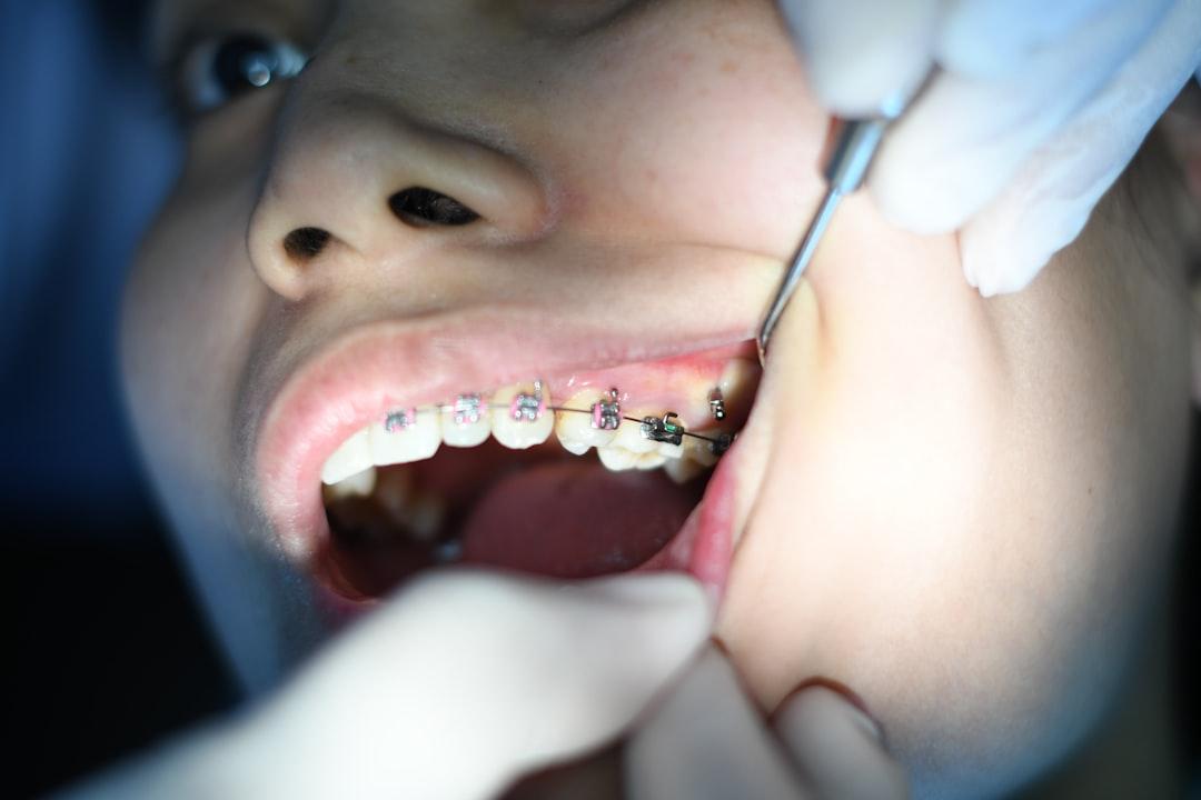 Orthodontic Billing Authorization Form